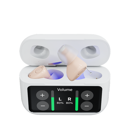 Atom X - White earbud case with wireless earbuds inside on a white background